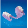 Superior Comfort Of Valplast Flexible Partial With Cast Thermo Plastic Denture Tmaterial